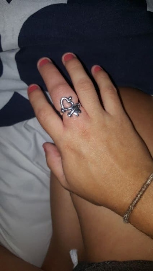 6. То, как отекают ноги, вы уже видели, теперь посмотрите, как отекают руки