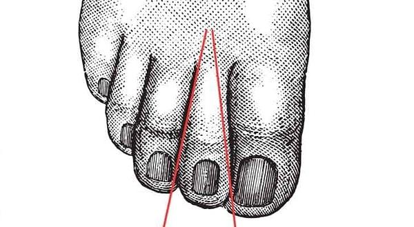 10. İkinci ayak parmağında darlık