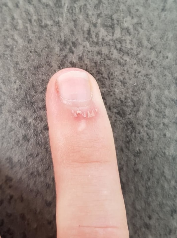 1. Всем же знакомо! Больно, неприятно, раздражающе!