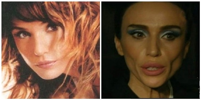 Звезды, которые сделали себе "Голливудские щечки" и стали абсолютно другими людьми