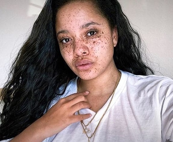 Жизнь вознаградила девушку за то, что та не сломалась и научилась любить себя такой, какая она есть.