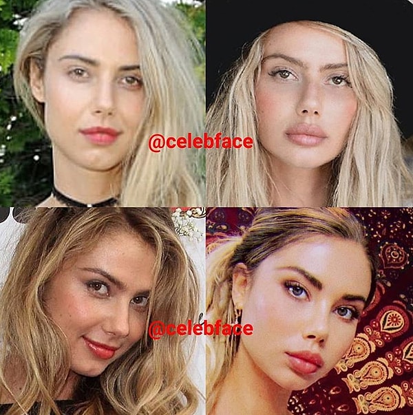 1. Даже милые девушки ложатся под нож хирурга, чтобы соответствовать моде