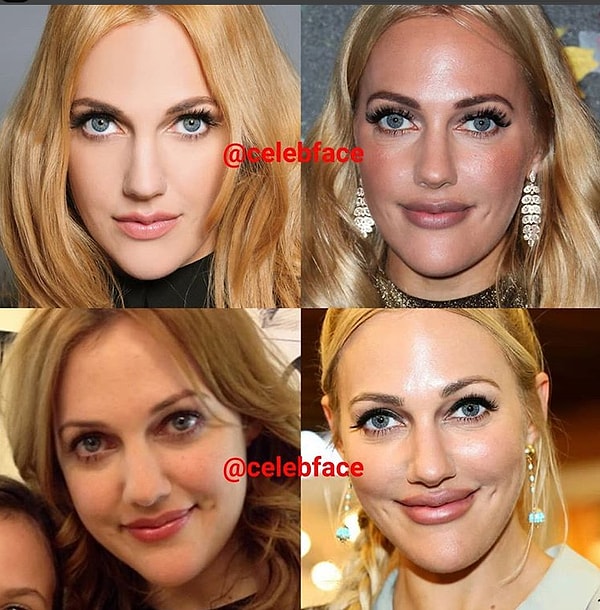 2. От пластики неудержалась и звезда "Великолепного века" Мерьем Узерли