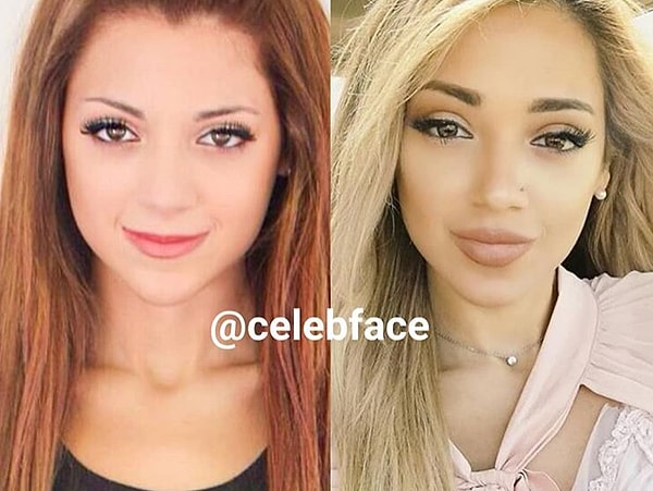 9. Все меньше остается девушек с естественными губами