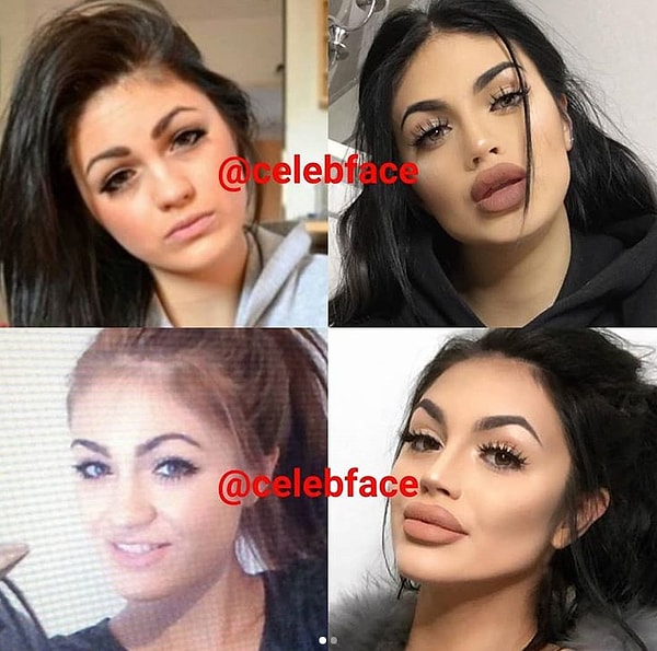 13. Многие из тех, кто приходит к пластическим хирургам, в качестве идеальной внешности приводят в пример Ким Кардашьян