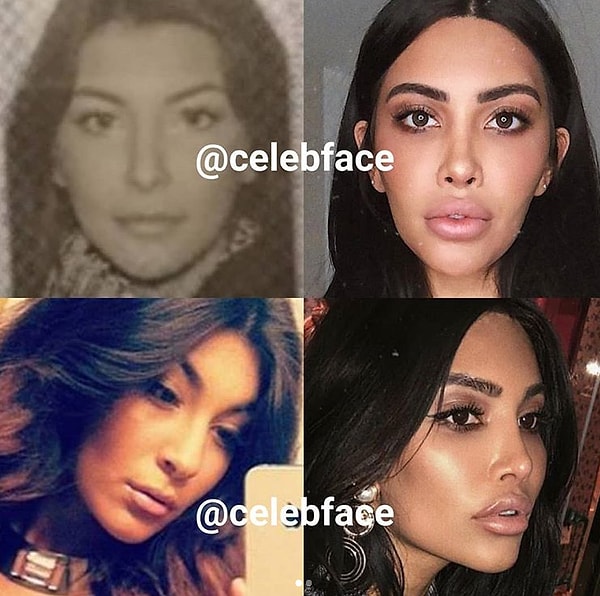 14. И действительно многие девушки после операций становятся очередной копией Ким