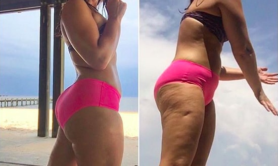 "Занимайся сколько можешь": Советы девушки, которая добилась желаемой формы и отказалась от неё, чтобы быть счастливой