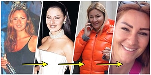 Her Şeyden Vazgeçse Bile Botoksundan Vazgeçemeyen Pınar Altuğ'un Hepinizi Şaşırtacak Yıldan Yıla Değişimi