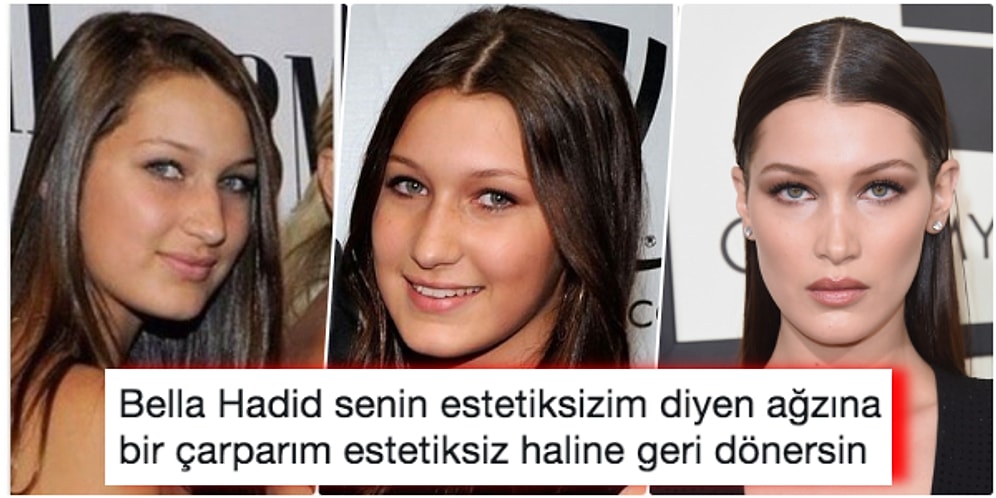 Victoria's Secret Modelinden Şok İtiraflar Geldi! Bella Hadid Hiç Estetik Yaptırmadım Dedi, Ortalık Karıştı!