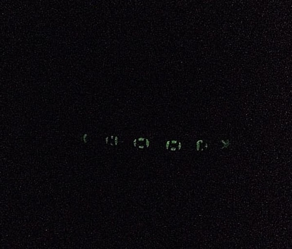 7. Если у вас были брекеты, светящиеся в темноте, вы наверняка ощущали себя самым крутым на районе :)