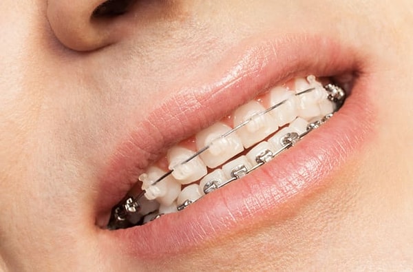 8. У вас 100% были мысли, что с прозрачными или белыми вы бы были нааамного счастливее!