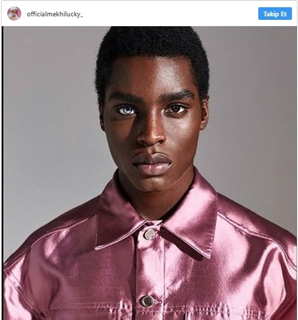 Бывший заключенный обладает глазами разного цвета!