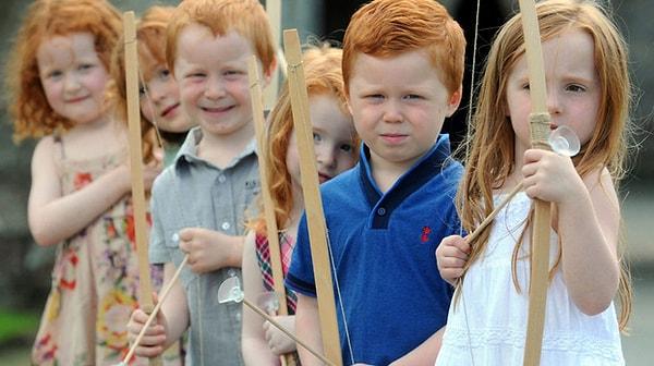 11. Kızıllık, İskoçya'da yaygın olarak görülmektedir. İskoçların en az %40'ının DNA'larında kızıl saç geni vardır. Bilim insanları bunun sebebini güneş ışığından yoksun olmalarına bağlıyor.