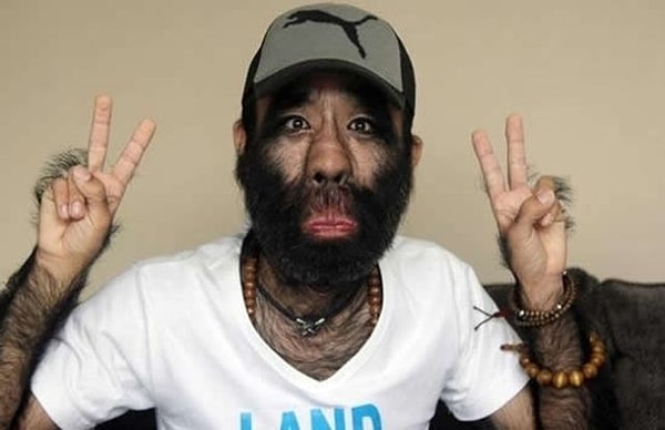 17. У самого волосатого человека в мире тело покрыто растительностью на 96%.