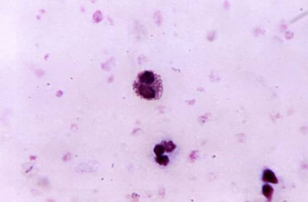 3. А менее всего их привлекают люди со II группой крови.