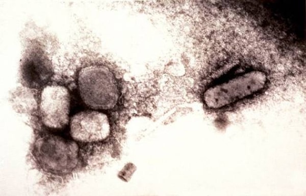 25. Люди со второй группой крови более предрасположены к оспе и серьезным случаям малярии. К счастью, первую удалось победить еще в 1980-м году.