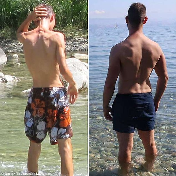 6. Дориан рассказывает, что в какой-то момент он просто-напросто боялся, что умрет от анорексии.