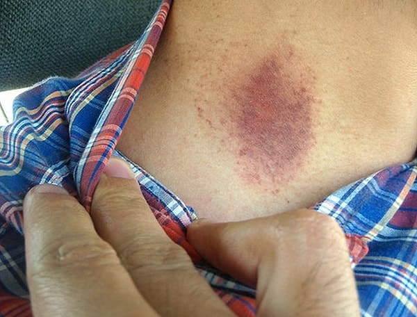 6. Родители Хулио во всем винят его девушку. Как сообщают мексиканские СМИ, узнав печальную новость, она поспешила скрыться от прессы и родителей погибшего.