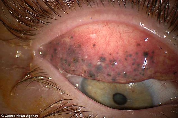 Мало того, что они проникли глубоко, они еще и наложились друг на друга, в несколько слоев.