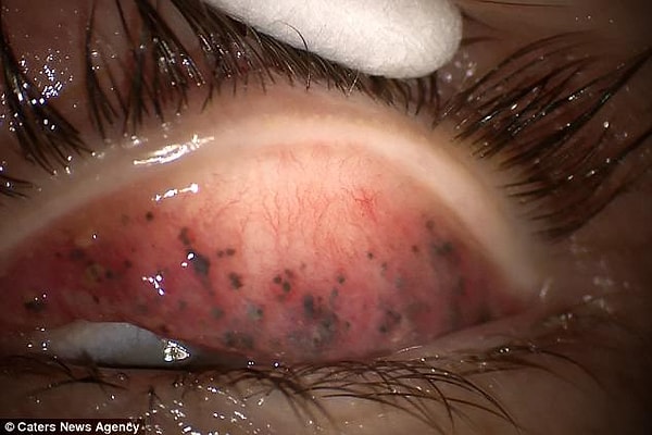 Врач Терезы признался, что видит такое впервые за долгие годы работы в своей должности.