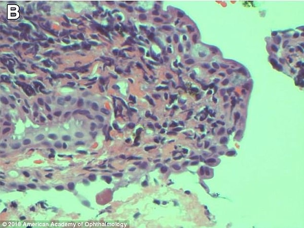 Вот как ситуация выглядит на медицинских снимках: