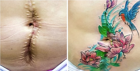 Krizi Fırsata Dönüştürmek Senin Elinde! Vücuttaki Yara İzlerini Adeta Birer Sanat Eserine Dönüştüren 29 Yaratıcı Dövme