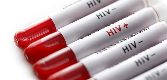 Kaynanadan Geline HIV Davası: Eşine Virüs Bulaştırdığı Gerekçesiyle Cinayetten Yargılandı