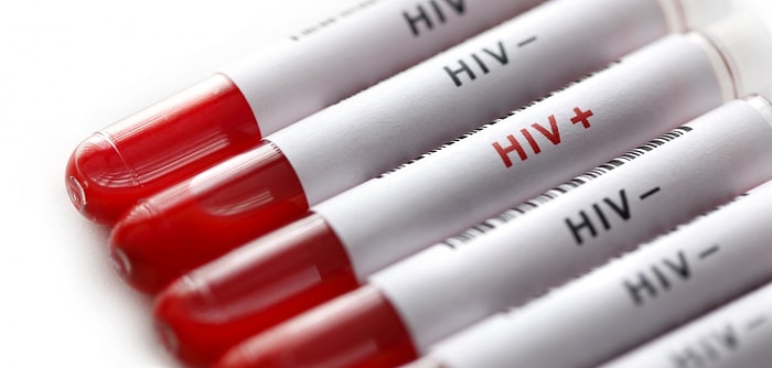 Kaynanadan Geline HIV Davası: Eşine Virüs Bulaştırdığı Gerekçesiyle Cinayetten Yargılandı