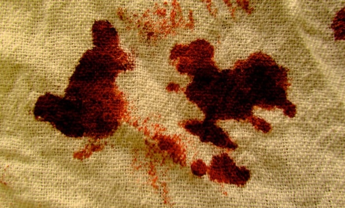 Rüyada Kan Görmek Ne Anlama Gelir?