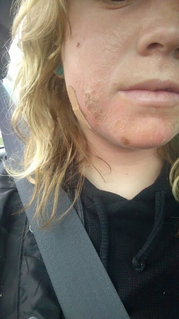 4. Не забывайте наносить сакскрин на лицо