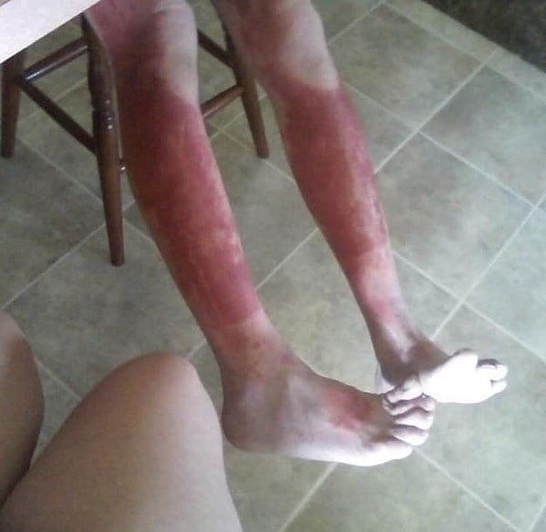 6. На эти ноги страшно смотреть