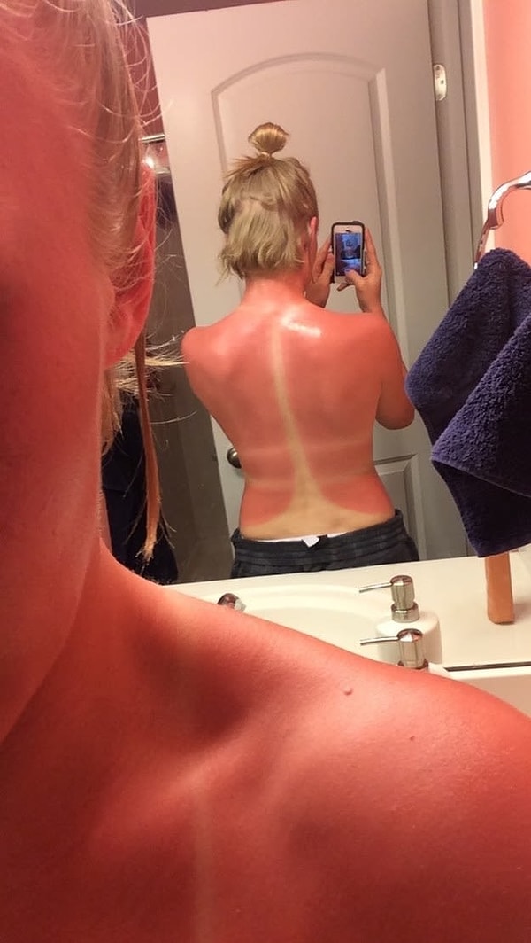 7. "Ближайшую неделю точно не смогу спать на спине"