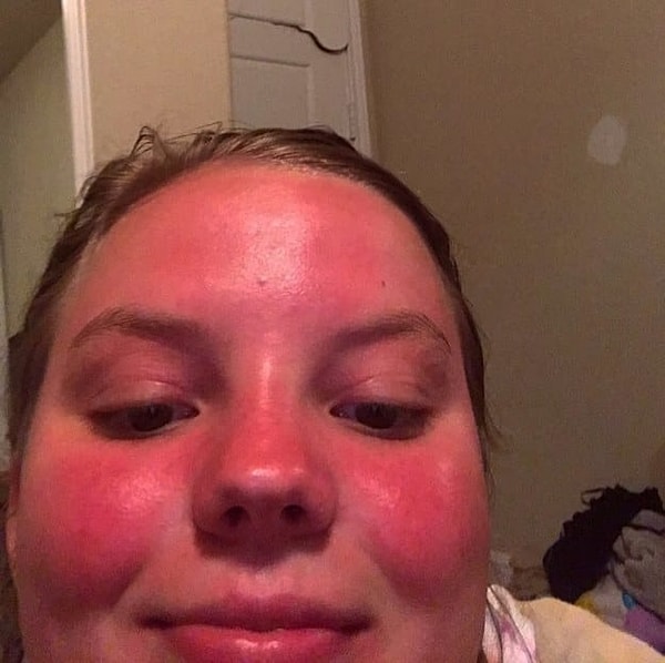 10. "Я с утра: "Да зачем мне вообще этот солнцезащитный крем". Также я:"