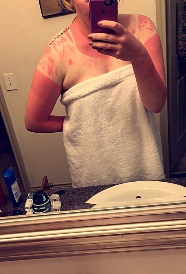 13. "Не пользоваться санскрином сегодня - не лучшее мое решение, как и выбор этой кофточки с прорезями"