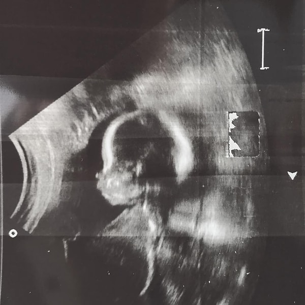 А теперь ближе к теме статьи - дочке, родившейся у этой альфа-пары, по имени Гравити!