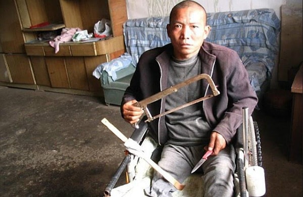 4. Чжэн Яанлин - ампутация