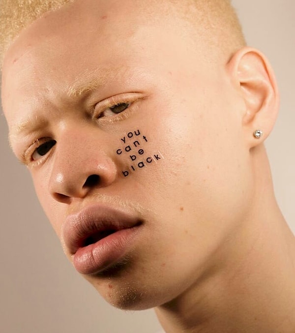 2. Питер говорит, что его вдохновило массовое движение бодипозитива. "Я люблю читать посты людей, которые полюбили себя и свою внешность, поэтому я тоже захотел неким образом внести в это свой вклад. Я боролся с проблемой акне ещё со школы, поэтому меня так это волнует".