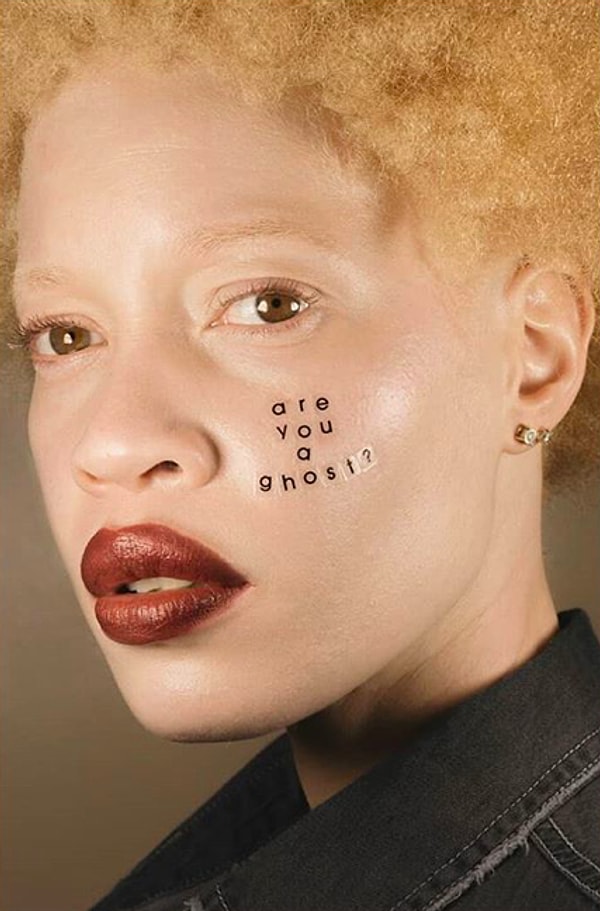 5. Вот, например, фраза, "написанная" на лице этой девушки-альбиноса. Люди регулярно спрашивают её: "Ты призрак?".