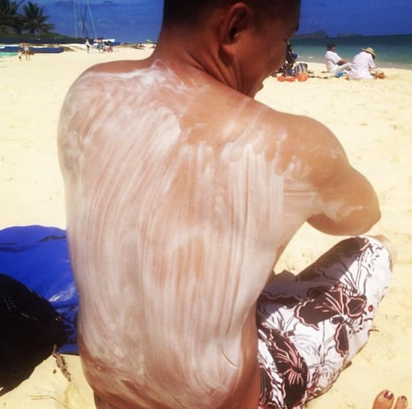 8. Этот парень точно знает, что сгоревшая спина - это очень плохо...