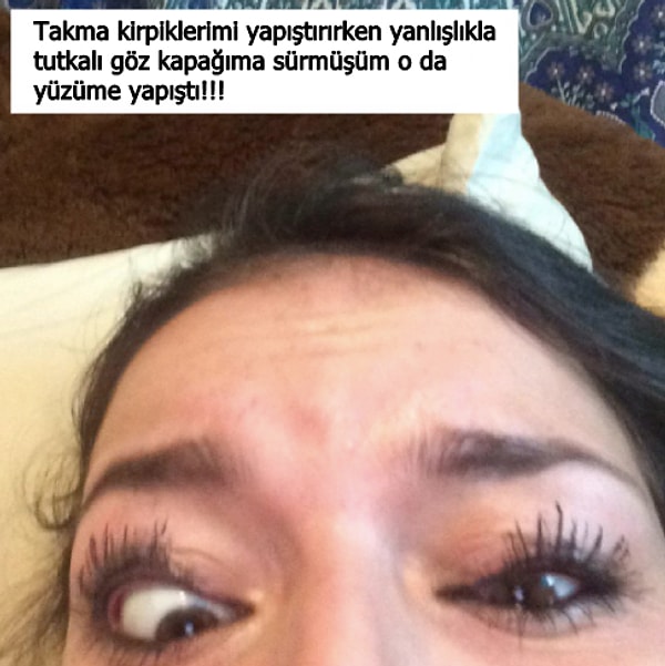 8. Göz kapağının içine de akabilirdi diyerek iyi tarafından düşünmeye çalışıyoruz ama olmuyor! 😳