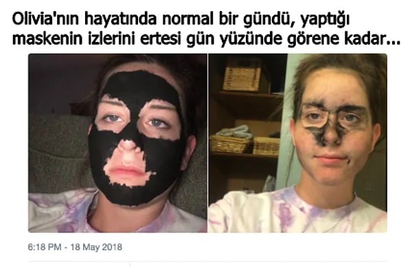 10. Siyah noktalar için yaptığı maske, ertesi gün suratında daha büyük siyah lekeler bırakmış. 🤭