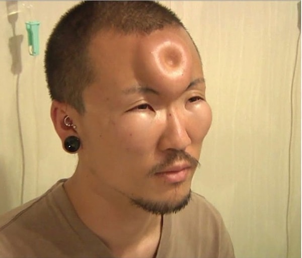 6. Несмотря на то, что этот тренд не очень распространен, инъекции в виде бубликов очень популярны среди любителей физических уродств. Такие "бублики" - явление кратковременное (16-24 часа), поэтому японцы предпочитают делать их непосредственно перед вечеринками.