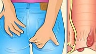 Hemoroidin Dayanılmaz Ağrısını Geçirebilecek 14 İyileştirici Tavsiye