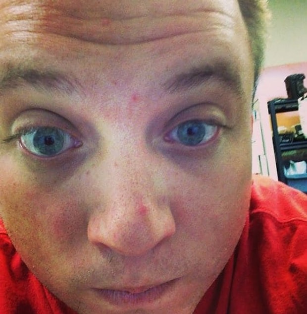 Hayrete Dusuren Bir Teori Daha Sivilceleriniz Size Bir Sey Soylemek Istiyor Olabilir Mi