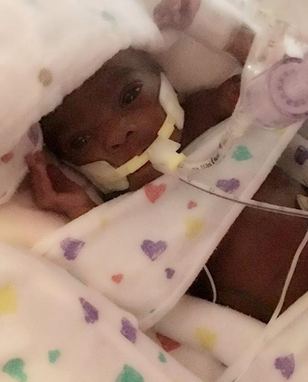 4 aylık hastane serüveninin sonunda Fontaine bebek hayata tutundu!