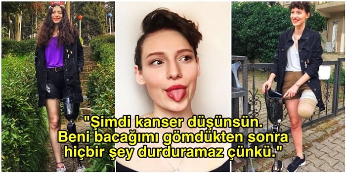 Bacağı Kesildi, Üçüncü Kez Kansere Yakalandı Ama Umudunu Hiçbir Zaman Kaybetmedi: Neslican Tay Hayata Meydan Okuyor