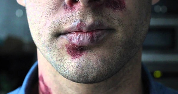 8. Передается ли половым путем ВИЧ?