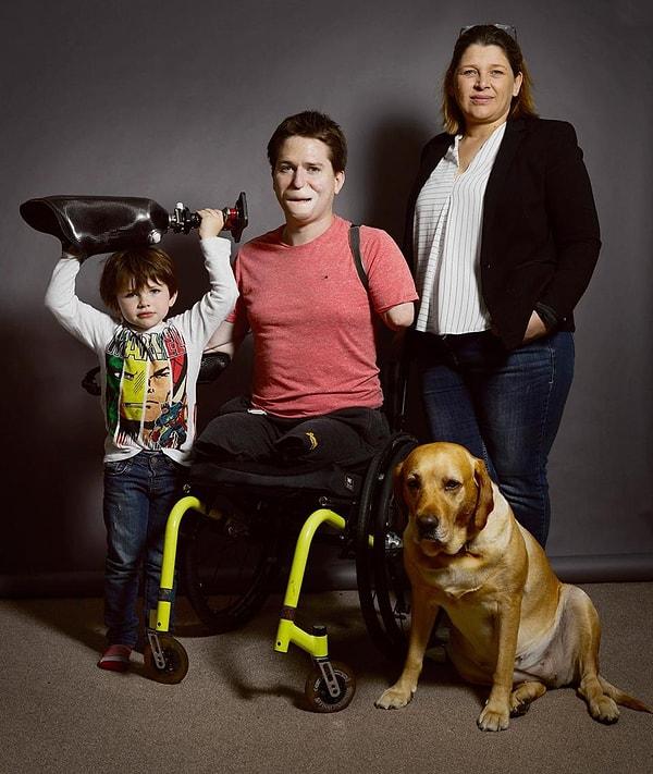 Oğlu Sam, nişanlısı Lucy ve köpekleriyle poz veren Alex, 4 yıl boyunca çektiği acının ardından Ampüte Kampanyacısı olmuş.
