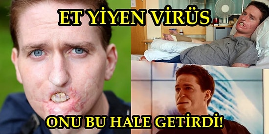 Et Yiyen Virüs Yüzünden Tüm Uzuvlarını Kaybetmesine Rağmen O Günleri "Hayatımın En İyi Yılıydı!" Diye Tanımlayan Adam