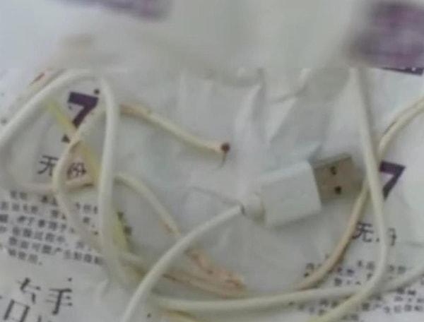 Operasyondan sonra penisinden çıkartılan kablo: